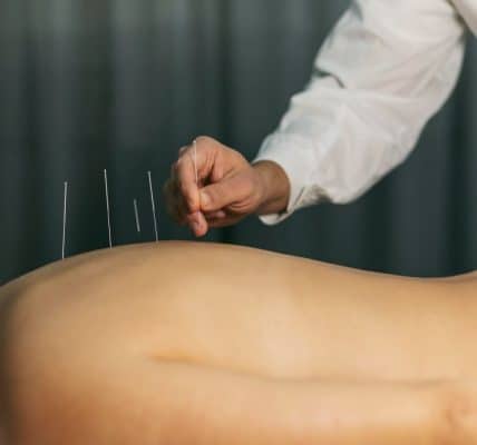 proceso acupuntura