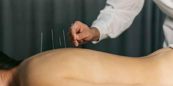 proceso acupuntura
